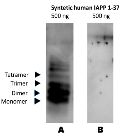 Western blot using anti-IAPP chicken antibodies